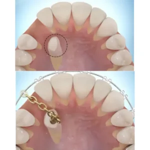 Cirugía Bucal - Oral and Facial Care