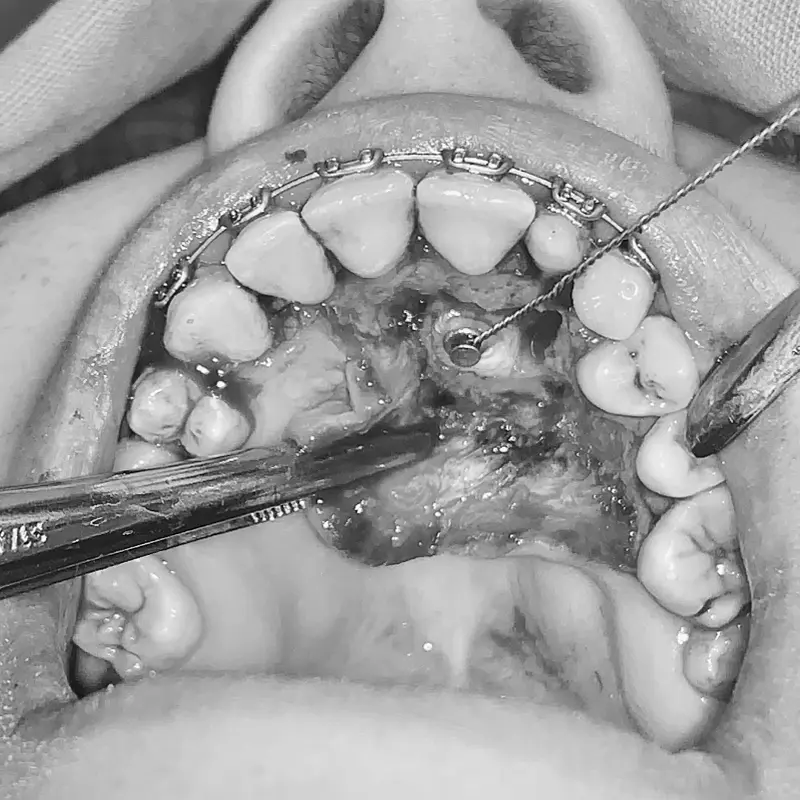 Cirugía Bucal - Oral and Facial Care