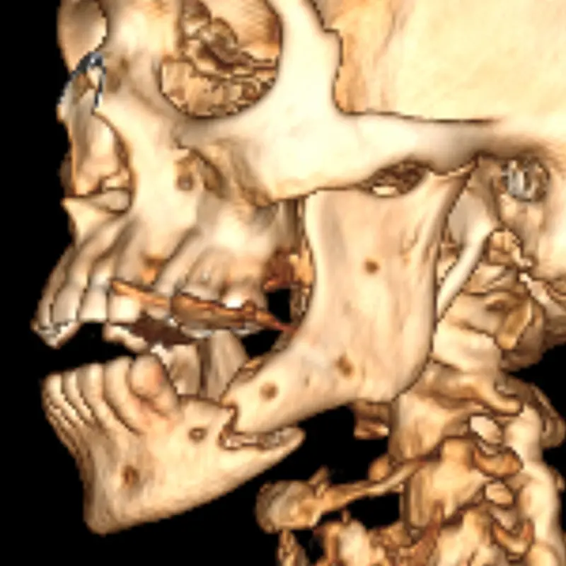 Tumores odontogénicos
