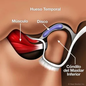 Trastornos de la articulación temporomandibular (ATM)