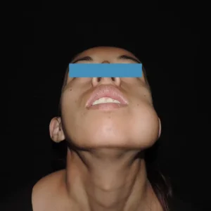 Tumores odontogénicos