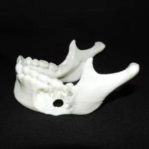 Tumores odontogénicos